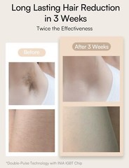 Inia Haute T033KW Unisex Adults Intense Pulsed Light IPL Hair Removal Device