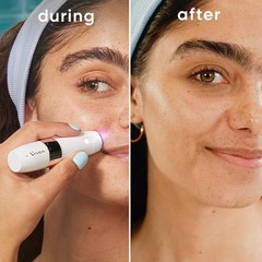 Gillette Venus Mini Facial Hair Remover For Womens Face Portable Electric
