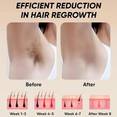 Professional Laser Epilator IPL Hair Removal Body Bikini Leg Depilatory Devic 90