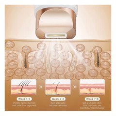 Aopvui FZ-608 Laser Hair Removal Hand-held IPL Device 999900 Flashes