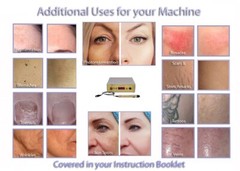 Face Sculpting Photo Rejuvenation Hyper Pigment Age Spot Removal 1064 Laser Kit.