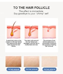 High-quality 755/808/1064nm laser hair removal device, painless hair removal.