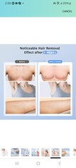Ice-cool Hand-held IPL Hair Removal Device (ITEM 8)