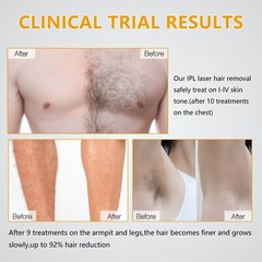 IPL Laser Hair Removal Epilator Permanent Body Machine Face Leg Painless Device