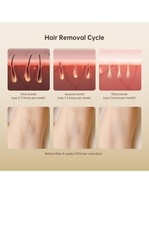 Laser Hair Removal, IPL Removal for Women and Men Permanent,…