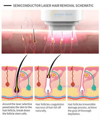 PRO IPL OPT LASER PERMANENT Hair Removal RF Skin Rejuvenation Beauty Machine