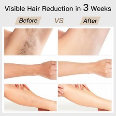Painless IPL Hair Removal Device with 6 Modes & Fast Flash Technology – Green