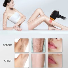 2-in-1 808NM Diode Laser Hair Removal Device & Picosecond Laser Tattoo Removal