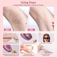 IPL Laser Hair Removal, Laser Hair Removal Device for Women Man, Painless Ful…