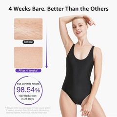 Precision IPL Laser Hair Removal with Ice Cooling – Perfect Holiday Gift for Her