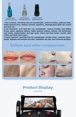 4in1 soprano laser hair removal nd yag laser pigment removal machine ipl + RF