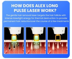 755/1064nm Alexandrite Long-Pulse Fiber Semiconductor Laser Hair Removal Machine