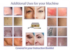 Advanced Laser Hair Removal System for Men & Women Pro Salon Home Use Machine *