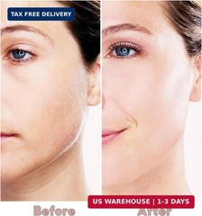 innobeaut Facial Hair Removal for Women, Electric Painless Facial Hair Remover f