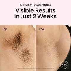 Wavytalk IPL Laser Hair Removal Device, Bare It with Precision Roller White