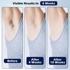 Luxduo Ipl Hair Removal Whole Body Hair Removal For Men And Women At Home