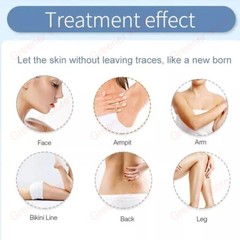 2IN1 Ice Titanium 755nm 808nm 1064nm Diode Laser Full Body Hair Removal Machine