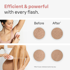 BraunSilk·expert Mini PL1014 Hair Removal System, CompactEasy, Safe and Efficien