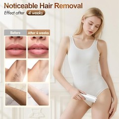 Laser Hair Removal, IPL Hair Removal for Women and Men with 5 °C Sapphire White