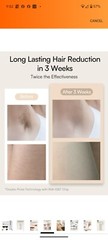 Inia Haute T033KW Unisex Adults Intense Pulsed Light IPL Hair Removal DeviceREAD
