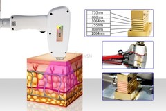 1064/755/810nm Painless Diode Laser Hair Removal Machine Body Skin Rejuvenation