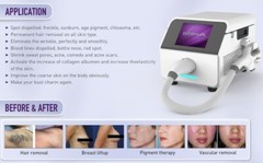Intense Pulsed Light (IPL) Hair Acne Vascular Chilled Tip (FDA 510k – Pending)