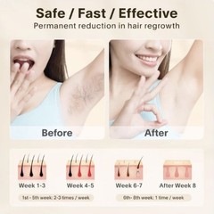 IPL Hair Removal Device 999999 Flashes – Permanent Hair Remover for Women