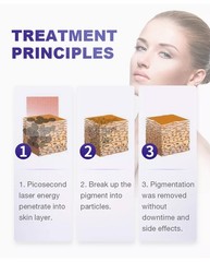 755 808 1064 Diode Laser Permanent Hair Removal Picosecond Nd Yag Tattoo Removal