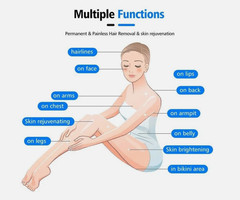 High-quality 755/808/1064nm laser hair removal device, painless hair removal.