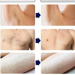 Alma Ice Soprano Titanium 755/808/1064nm Diode Laser Hair Removal Machine
