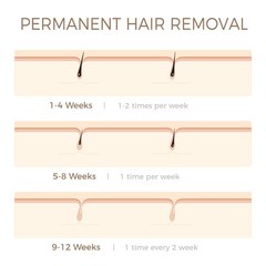 IPL Hair Removal Device for Women & Men, Permanent Hair Reduction System