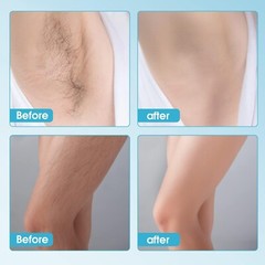 AIMO IPL Hair Removal Ice Cooling Function Facial Hair Removal 500,000 Flashes