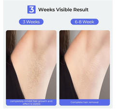 Painless IPL Ice Cooling Permanent Hair Remover D-T003