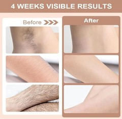 LIVGLO 3-in-1 IPL Hair Removal Device, Ice Cooling Laser Hair Remover with HR