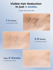 Ubroo Laser Hair Removal,IPL Hair Removal Device with 5℃ Ice Cooling,At-Home