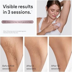 Braun IPL Mini Silk Expert Mini IPL1111 Hair Removal