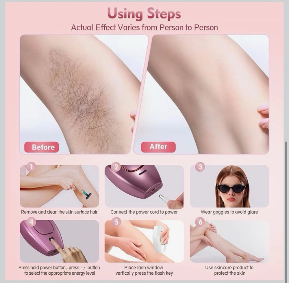 IPL Hair Removal Device, 5 Energy Levels, Auto/Manual Modes, Includes Sunglasses