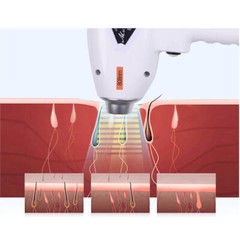 755 808 1064nm Diode Laser Bikini Body Hair Removal Permanent Skin Care Machine