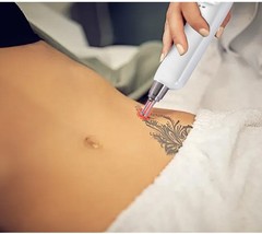 755 808 1064 Diode Laser Permanent Hair Removal Picosecond Nd Yag Tattoo Removal