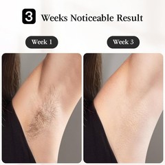 JOVS Laser Hair Removal, IPL Removal for Women and Men, 37°F Green