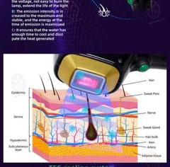 2000W Ice Titanium 755nm 808nm 1064nm Diode Laser Painless Hair Removal Machine