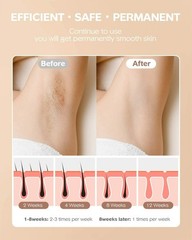 IPL Hair Removal Permanent Painless Hair Remover for Women Legs Arms Face Bikini