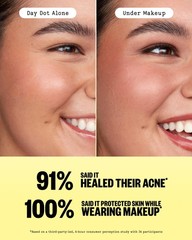 PEACE OUT Acne Day & Night Duo, Invisible Hydrocolloid 20 Count (Pack of 1)