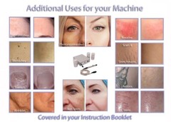 Multi Function Hair Veins Wrinkle Scar Stretchmark Pigment Removal IPL Laser.