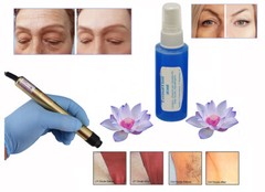 Dermal Plast, reduces the discomfort from laser and IPL treatments for clients.
