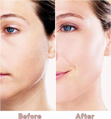 Facial Hair Removal for Women, Electric Painless Facial Hair Remover for Face, L