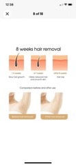 IPL Hair Removal Laser Permanent Body epilator Painless Device 999,999 Flashes