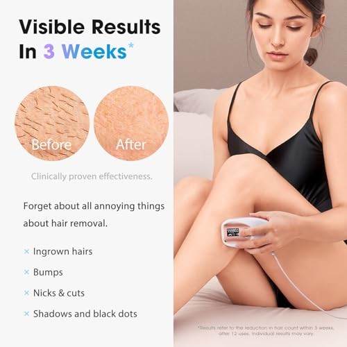 OREETH IPL Laser Hair Removal Device, 45°F Ice-Cooling, TM002 – Rose Gold