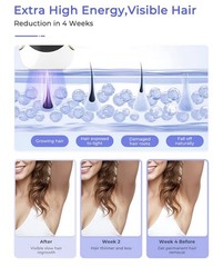 Finquin Air 15 IPL Laser Hair Removal Device – Nearly Painless & Quick Results