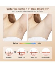 Laser Hair Removal for Women Permanent Painless At Home IPL Laser Hair Remova…